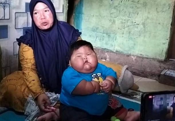 16個月嬰兒27公斤！嬰兒車載不下「還在變胖中」…相當於一般8歲童