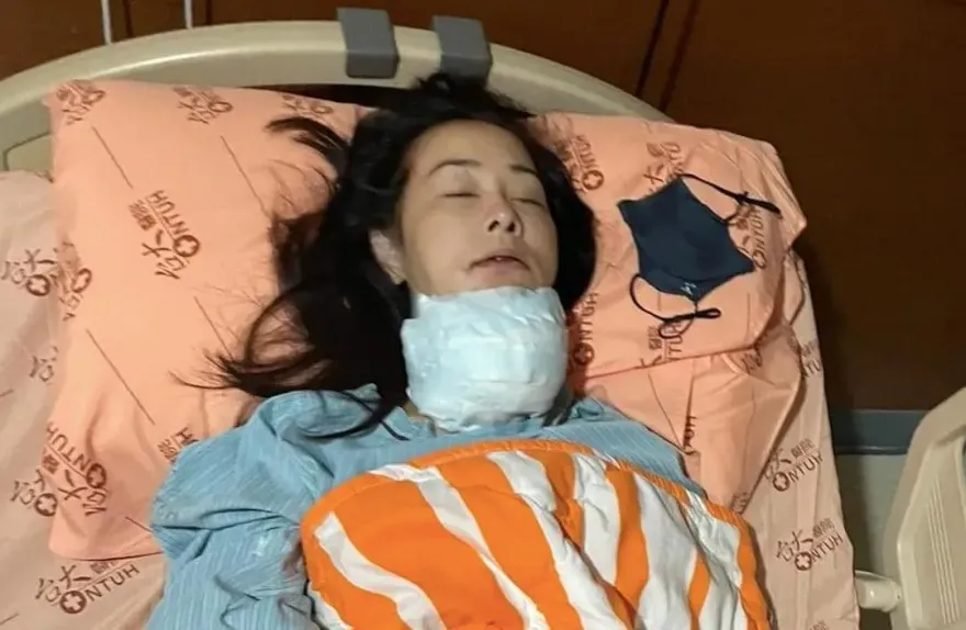 八點檔女星兵家綺罹患甲狀腺癌　開刀淋巴疑似驚見「腫瘤」...停工現況曝