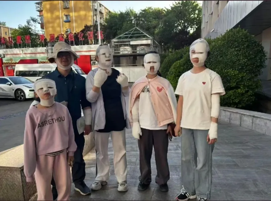 影/卡式爐烤肉突爆炸！北京7人被炸傷慘變「木乃伊」