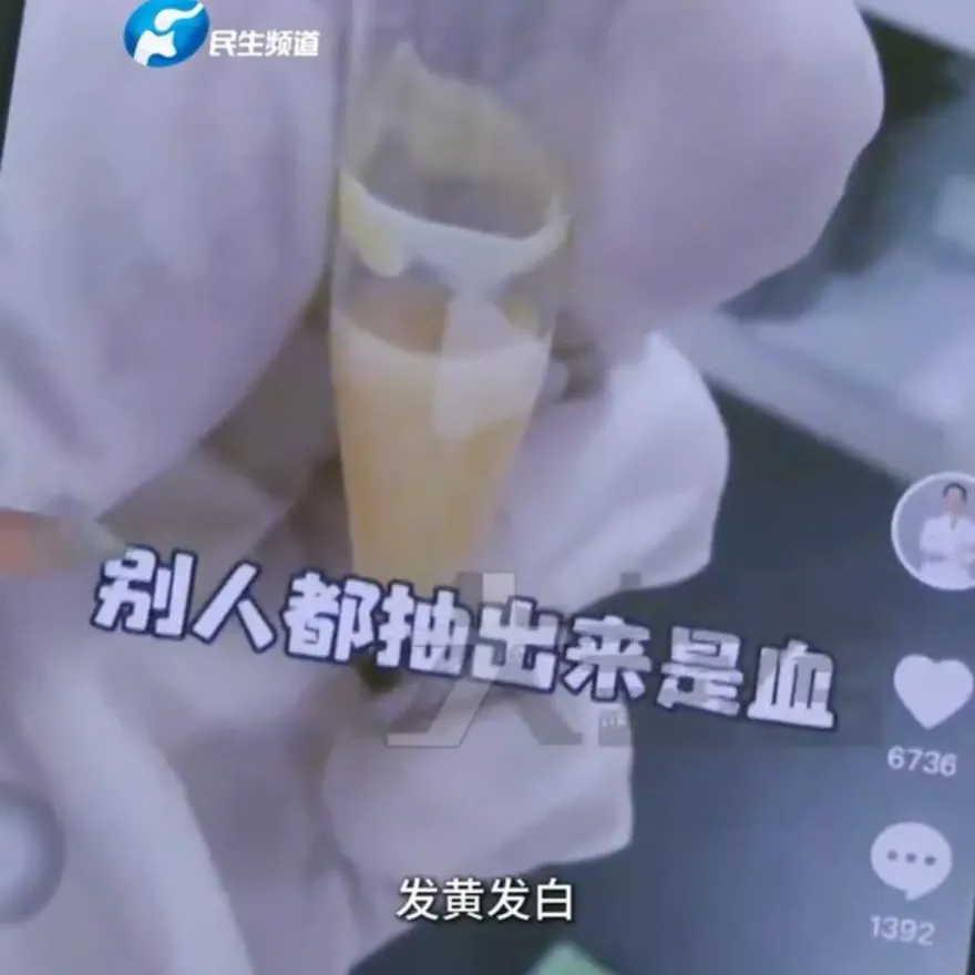 天天吃火鍋「連吃4個月」！陸女抽出「奶油血」數值超標45倍