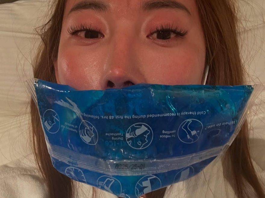 眭澔平爬聖母峰險喪命！同團曾格爾也出事　潰爛滲血傷照曝