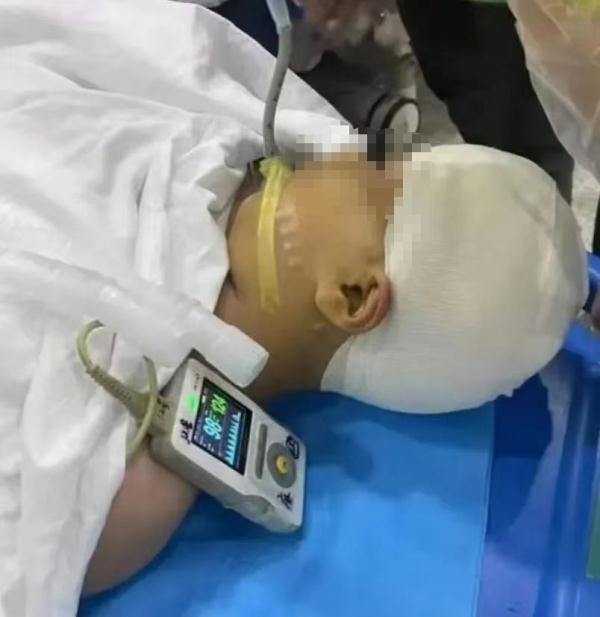 9歲女童遭男師打破頭骨「腦漿流出」　甦醒駁誤傷說法：故意打了2次