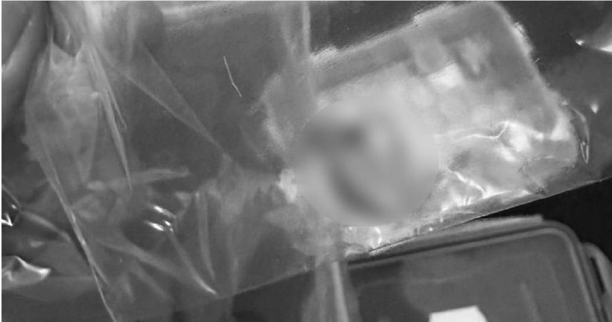 女騎士自撞無事返家...清理現場卻見「詭異斷指」！　里長嘆：接不回了