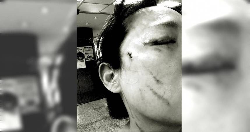 提醒戴口罩遭「挖眼砍傷」輕判8個月　苦主怒上訴：再死人才會被重視？