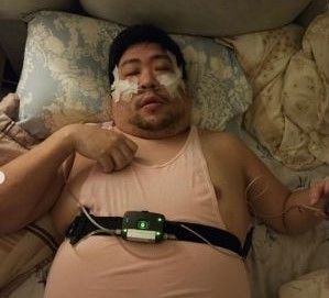 統神哥哥曬「插管照」嚇壞粉絲！他曝病重嘆：呼吸停止45次