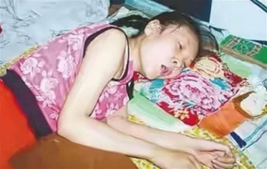 裝病最高境界！35歲女「癱瘓20年」靠家人照顧　監視器揭騙局：假的