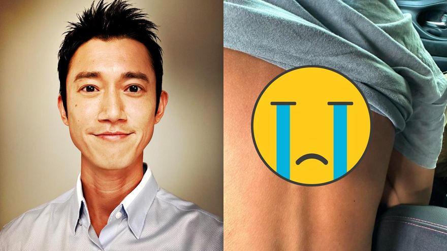 吳慷仁慘遭「虎頭蜂叮一大包」！拍戲出意外急送醫　痛喊：像被踹再用220V電擊