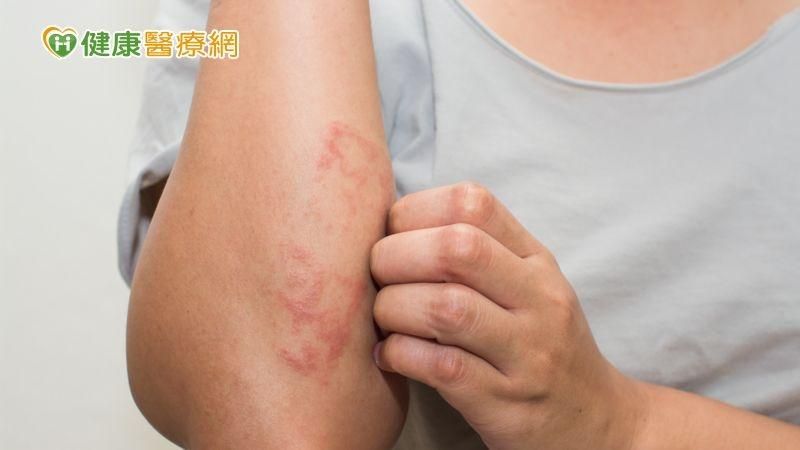 吃藥治痛風竟產生「致命副作用」！醫示警：死亡率超高　康復仍可能失明