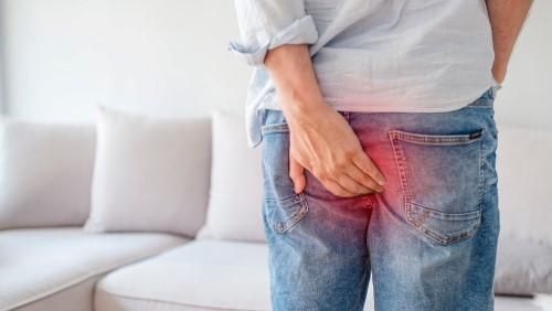 十男九痔！男生真的容易得痔瘡？ 專業醫師痔瘡迷思大解析