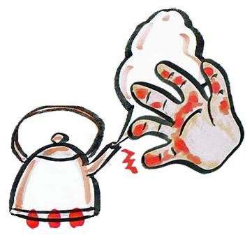 燙傷4個NG動作恐感染　醫：勿聽信偏方