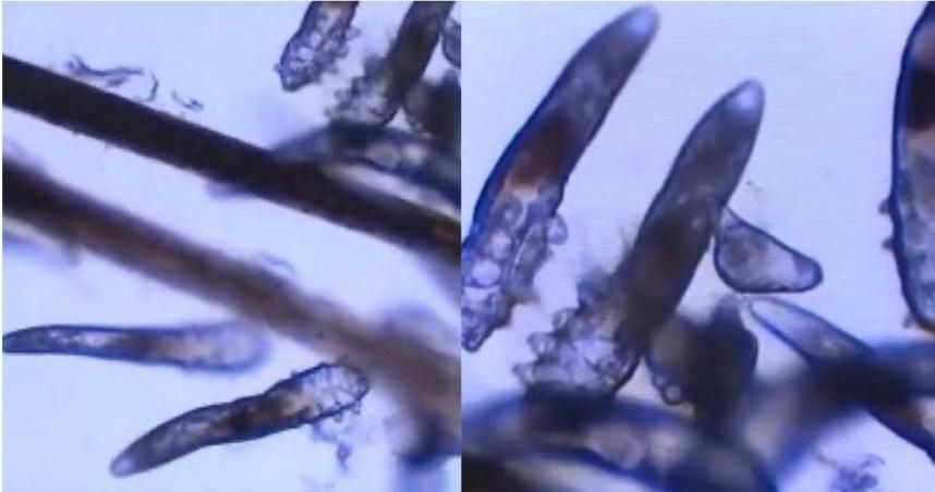 驚！蟎蟲入侵母女眼　竟是寵物惹的禍