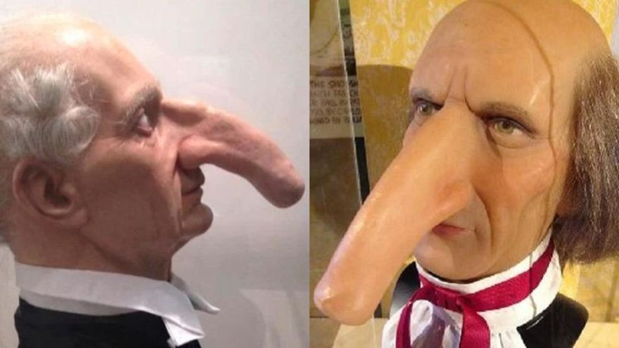 真人版章魚哥！英國男「鼻子長達19公分」　18世紀以來無人破紀錄