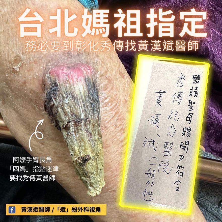 媽祖唯一指定！91歲嬤手臂長角　曝收「仙界轉診單」