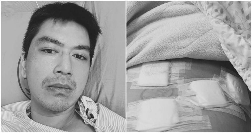 驚！八點檔男星剛迎二寶　不料十二指腸長腫瘤「肚開4洞」病床照曝光