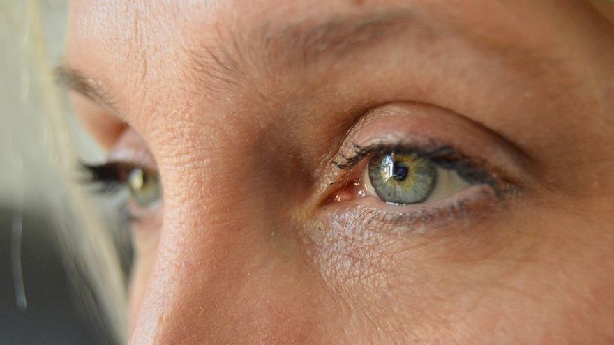 擺脫「乾眼症」可求助中醫！ 醫：應從脾、肺、肝、腎等方面進行治療