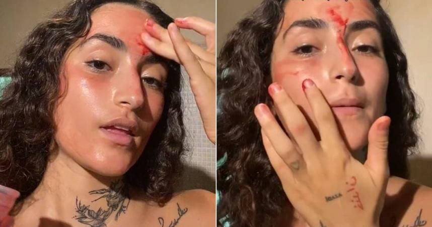 美女提倡「月經面膜」對身體有益　專家打臉警告「細菌很多！」