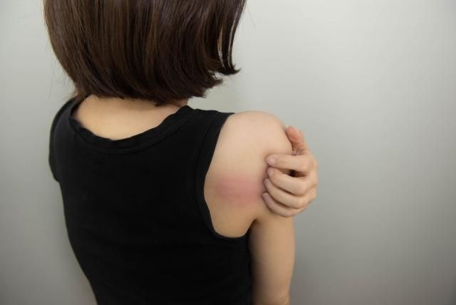 7成異膚患者認「皮破血流」是日常！　醫示警：不治療恐影響身心發展