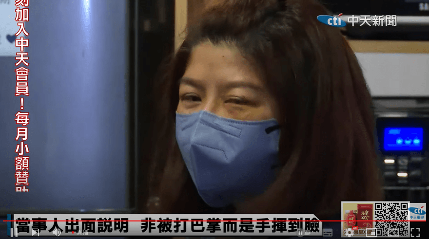 影/太玄宮執事自稱「被揮掉眼鏡」　臉上傷痕是被刮傷而非打傷