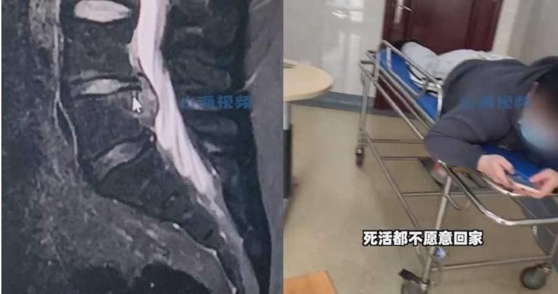 功課教10幾遍學不會　老爸氣暈「摔斷尾椎骨」康復拒出院…不想再輔導7歲女