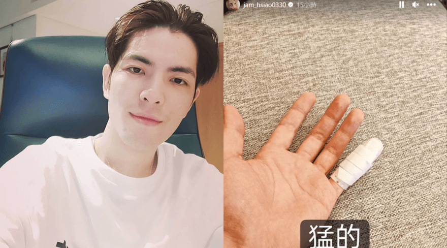 【影】蕭敬騰骨裂送醫！打球出事冷汗狂流　病況曝光嘆：要很久不能彈琴了…