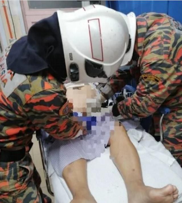戒指卡陰莖！男子急入院求救要消防「增援」！網民：戴錯地方？