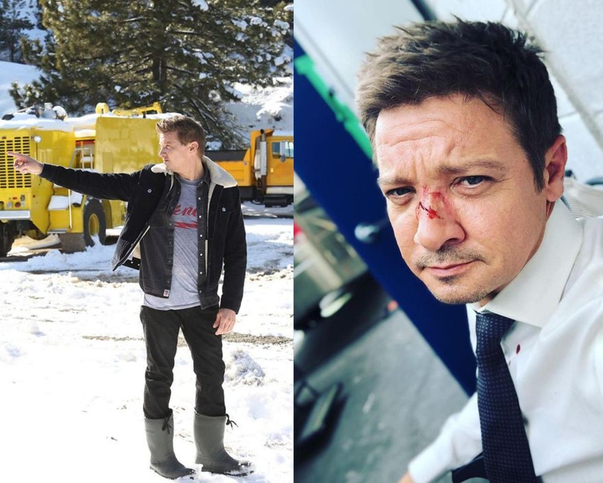 「鷹眼」慘遭除雪機「碾過腿部」爆血送醫！鄰居揭驚悚傷勢　動2手術保命→近況曝