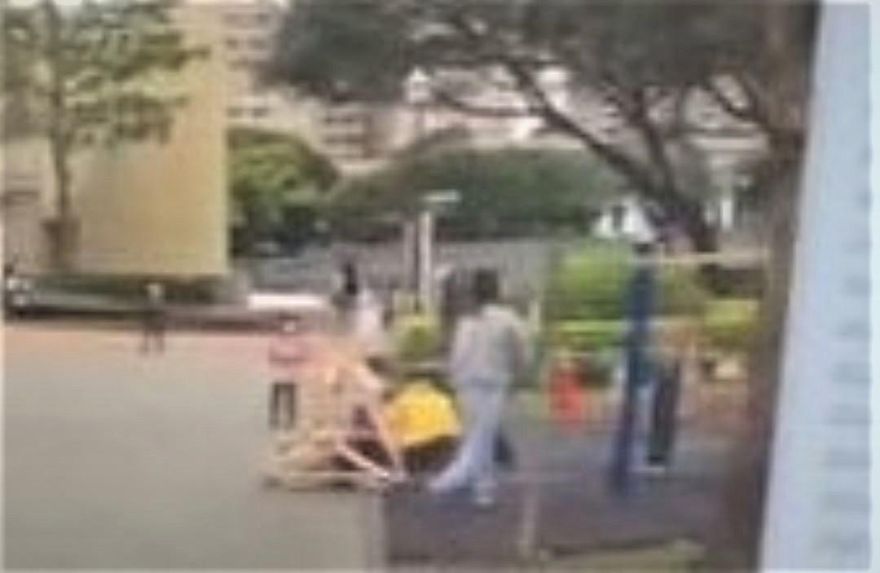 影/新北公園運動器材斷裂砸傷人！婦人頭破、腿骨折…公所「會負起責任」
