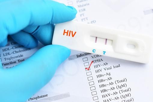 預防愛滋找上門！疾管署擴增「公費PrEP」據點　63家醫院約4千人可受惠