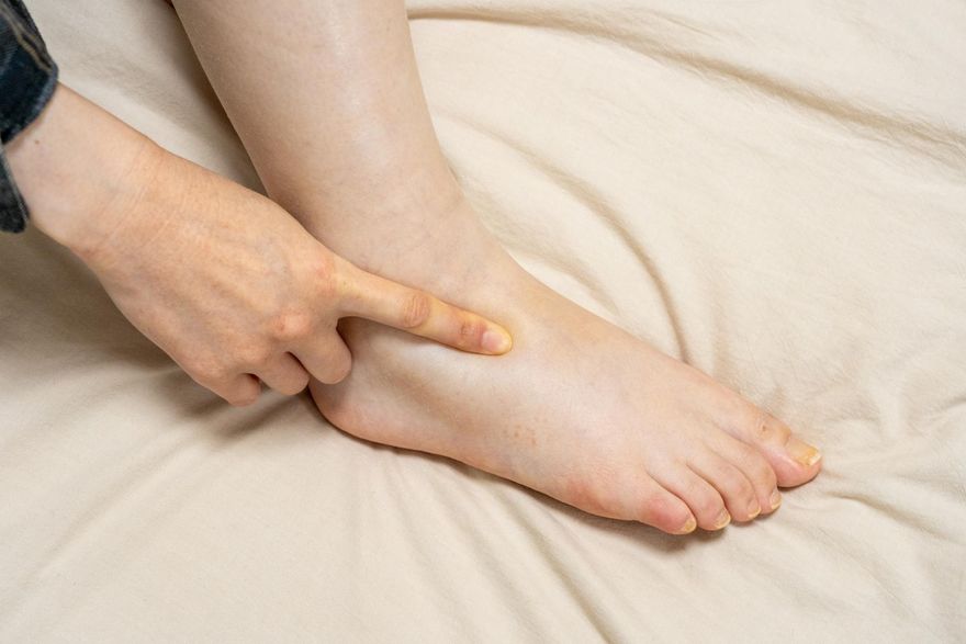 每天起床腫兩倍？網友推4大「消水腫 」方法　喝水也有效！