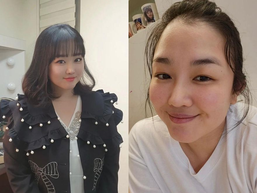 韓女星消失螢光幕1年...驚曝罹舌癌「切除3分之1舌頭」保命　醫曝6大好發因素