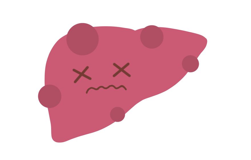 男吃抗病毒藥3個月救C肝！以為痊癒「狂做1事」　1年後竟慘罹肝癌