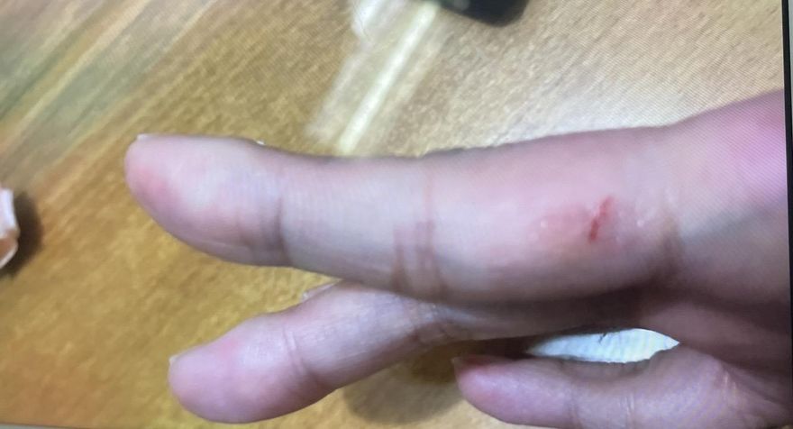 PPT爆女子搭捷運遭襲胸割手！警調影像未發現異常…研判真兇是它