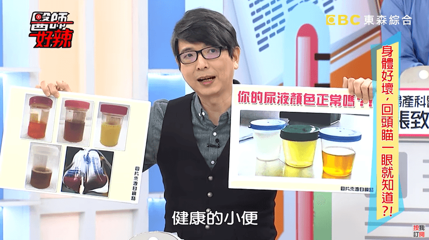 小便顏色一次看！「紫尿」細菌作怪　「養樂多尿」背後竟罹癌