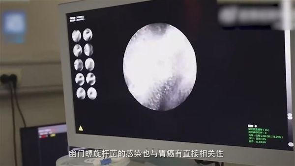 一胃痛就喝熱水...女半年後得「胃癌」　醫點出「這些因素」導致