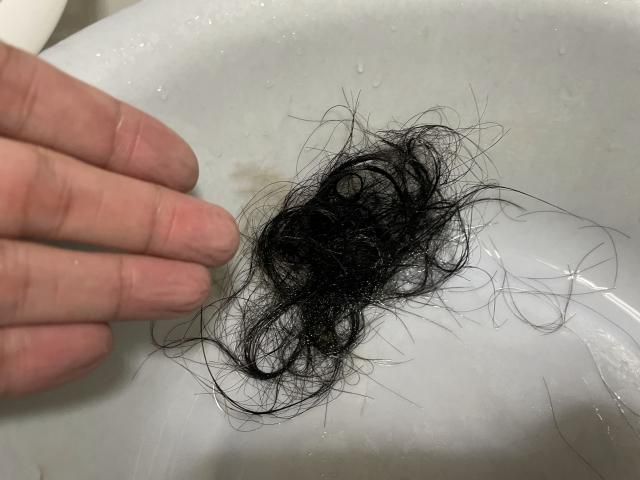 禿頭戴假髮不清潔　皮膚醫：恐加劇脫髮問題