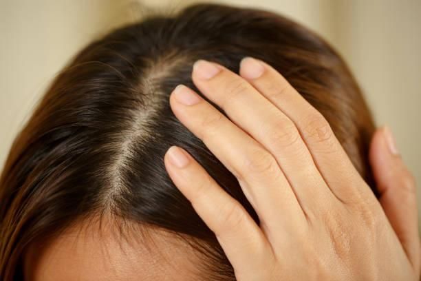 快訊/南投某小學爆「頭蝨群聚」！28學童緊急投藥治療