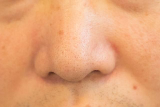 孫安佐「鼻部」受重創…功能受影響？醫：嚴重恐釀睡眠呼吸中止症