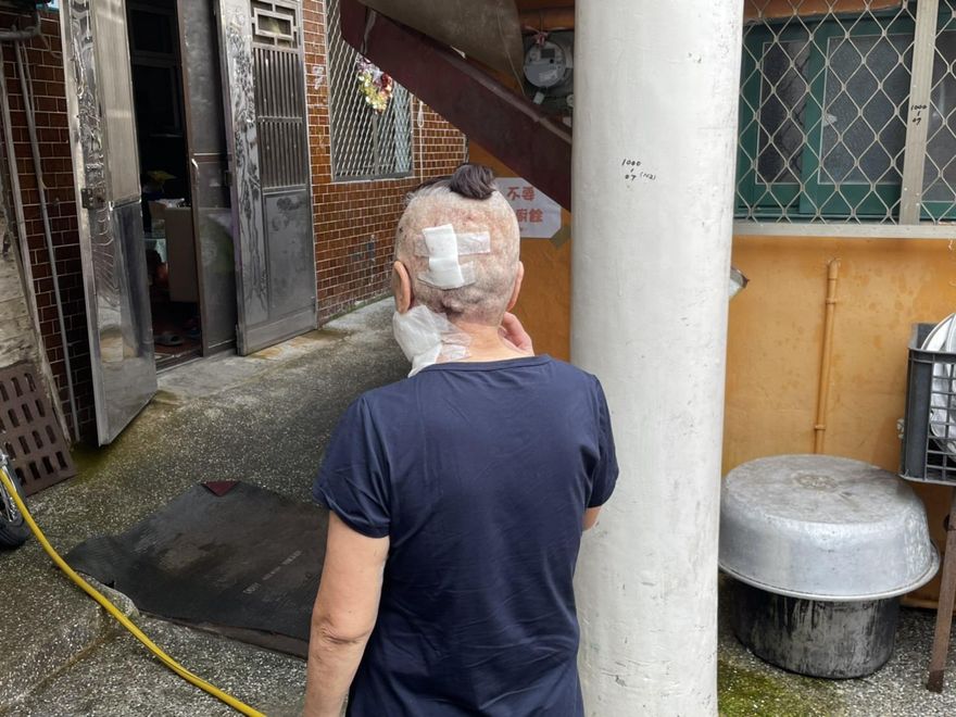 慘況曝光！烏來嬤好心餵食鄰居愛狗卻濺血　慘遭狂咬差3cm傷及頸動脈