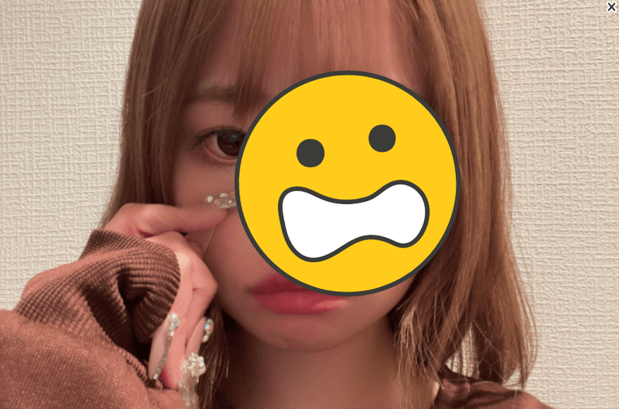 23歲AV女優車禍！頭受撞擊傷勢照曝光　停工2週嘆：不能愛愛了