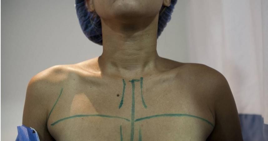女子隆乳手術後當晚猝逝！醫院查死因竟是「出血過多」