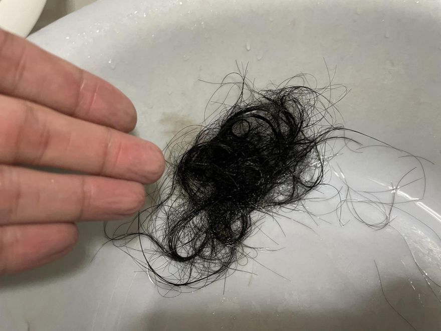 養髮液能改善落髮？頭皮與掉髮問題 醫師教你5招克服