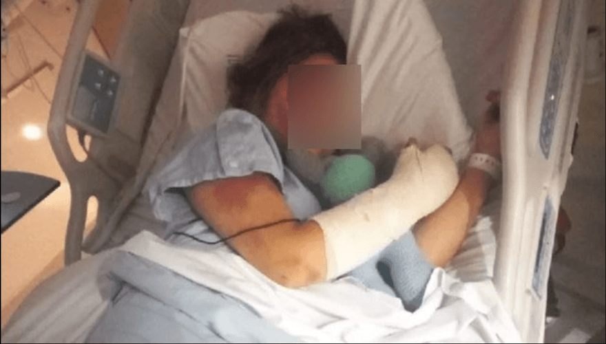 現實版黑暗榮耀！13歲女孩參加閨密派對中伏　她被脫半裸遭火燒刀割4小時