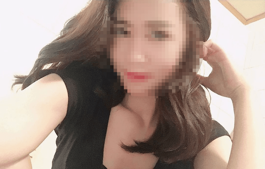 八大妹2度燙傷包紗布情緒轉穩定　網友憂心下半輩子恐全毀