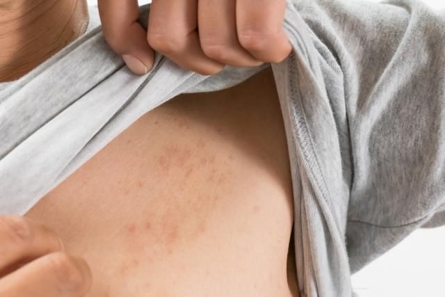男「皮在癢」抓到蜂窩性組織炎！醫曝「5大NG行為」勿擦嬰兒油、蘆薈膠