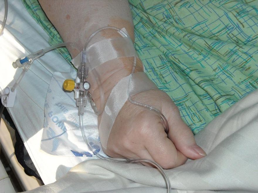 56歲中年男子下飛機腳腫到鞋子穿不下！送醫發現和心臟有關