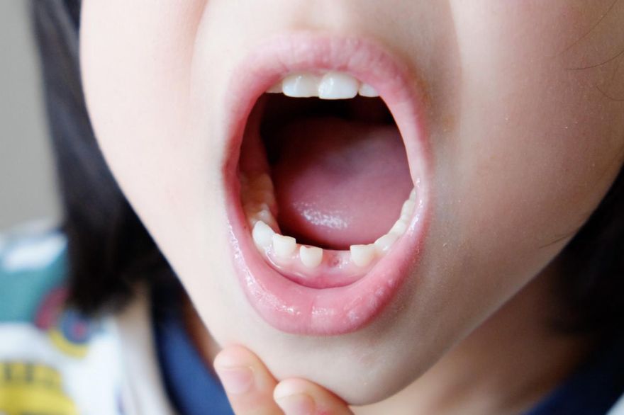 病毒流行季！小孩腸病毒嘴破吃不下　醫：開放「這些軟食物」應急