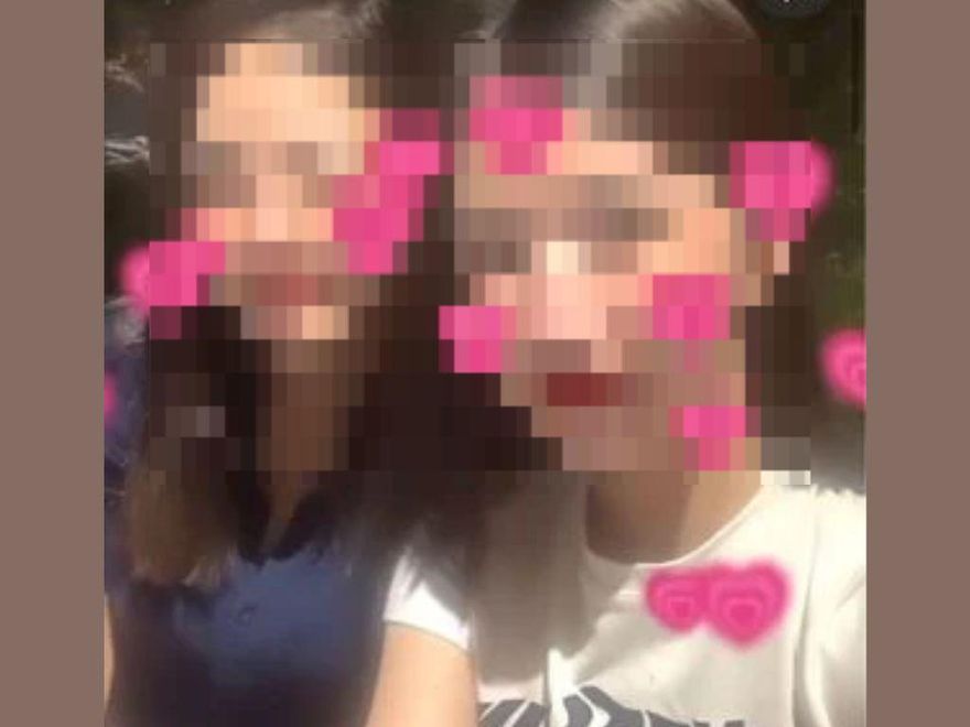 遭潑湯恐毀容！八大女「突曬自拍照」　美肌濾鏡蓋不掉傷疤