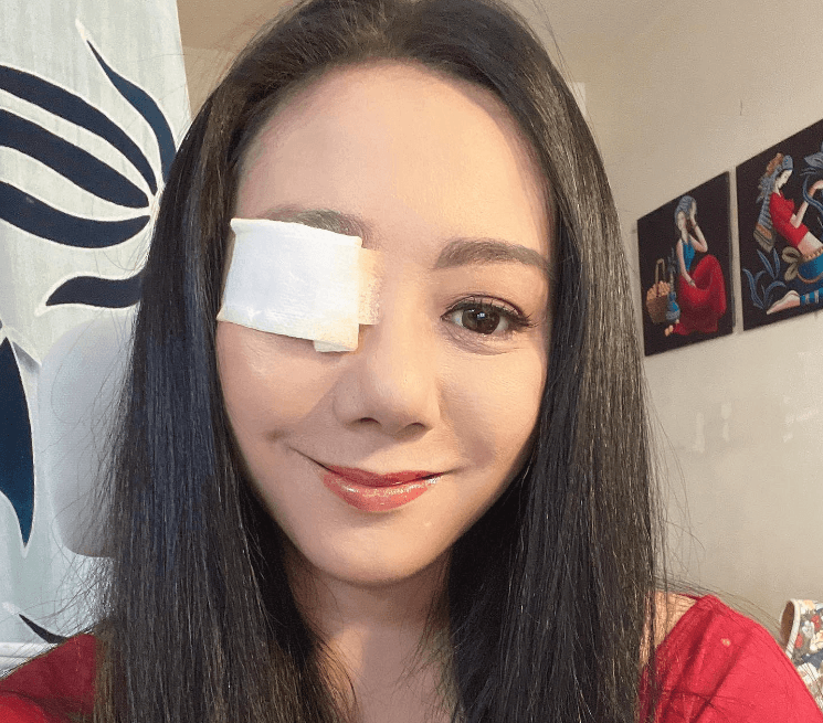高慧君眼疾纏身1年！爆「雙眼無法對焦」右眼2度開刀近況曝