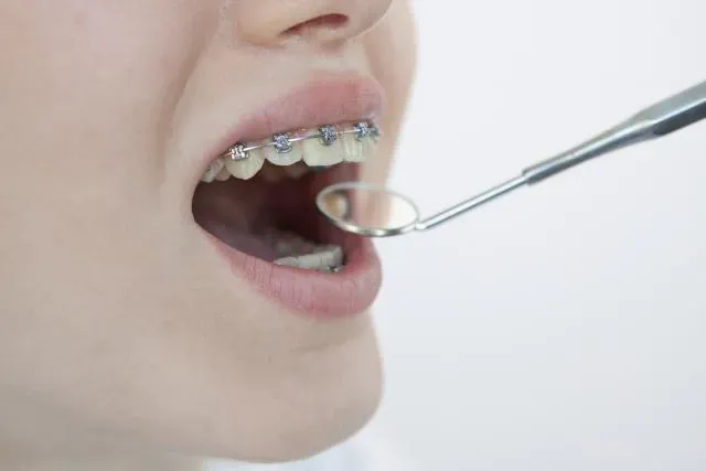 7旬嬤門牙潰爛　就醫檢查發現竟是「30年前蛀牙抽神經」惹的禍！