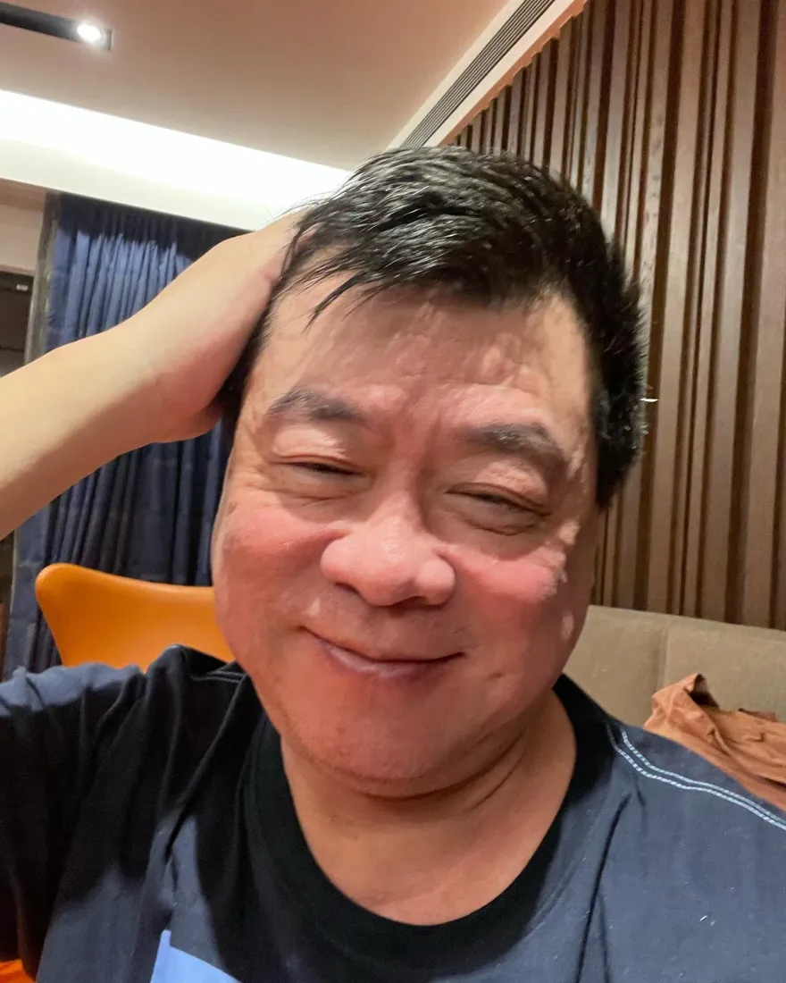 62歲孫德榮2度摔倒！撞到肋骨「痛到爬不起」：這是警訊